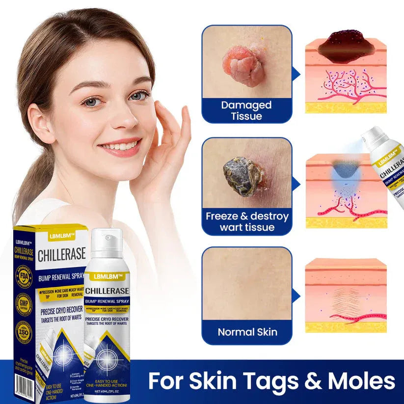 Timilk® ChillErase Bump Renewal Spray