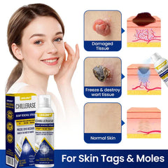 Timilk® ChillErase Bump Renewal Spray